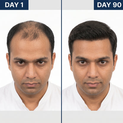 Deoxyline™ | Reverse Hairloss in 90 days - Triple Roll-On Serum