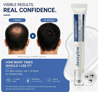 Deoxyline™ | Reverse Hairloss in 90 days - Triple Roll-On Serum